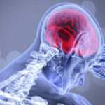 Diagnosticarea timpurie a bolilor neurologice este esențială