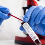 Numărul cazurilor de COVID-19 din România scade