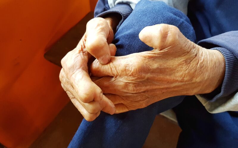 Lepra, confirmată și într-o altă țară europeană. „Persoana afectată a primit imediat tratamentul antibiotic prescris”