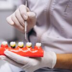 Poți beneficia de implant dentar dacă ai parodontoză?